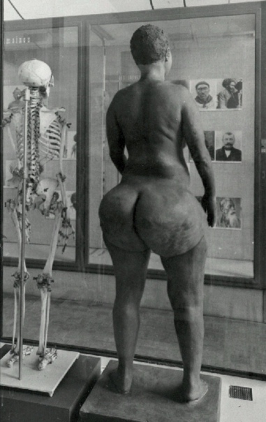Анатомические особенности женщины из африканского народа готтентотов.