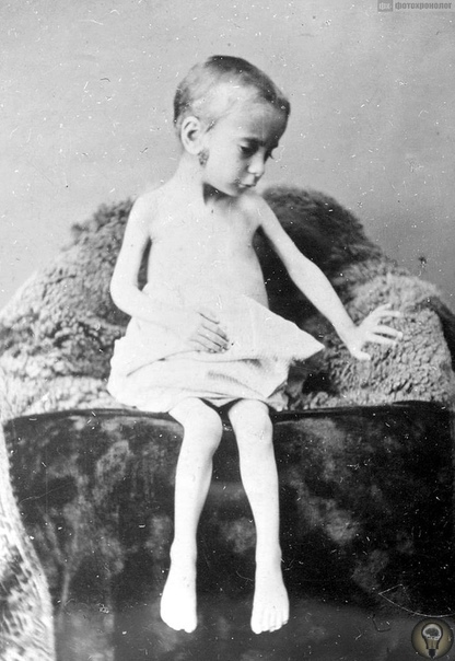 «Беспризорники Лондона: Кусачки Спиталфилдса», 1913 г. Ч.-1 «Одежда у них рваная, изношенная. А для большинства горячая ванна-это далекое воспоминание. Но в глазах этих детей есть самообладание